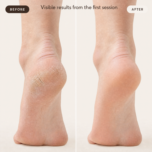 Plushfoot Electric Foot File